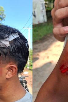 Seorang Atlet Alami insiden Pengeroyokan dan Sabetan Sajam di Area PKOR Way Halim