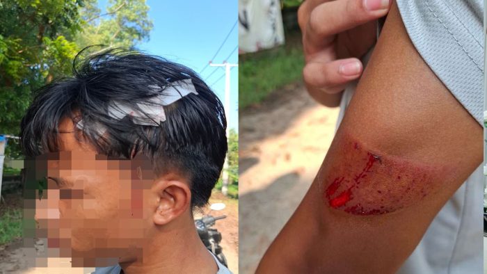 Seorang Atlet Alami insiden Pengeroyokan dan Sabetan Sajam di Area PKOR Way Halim
