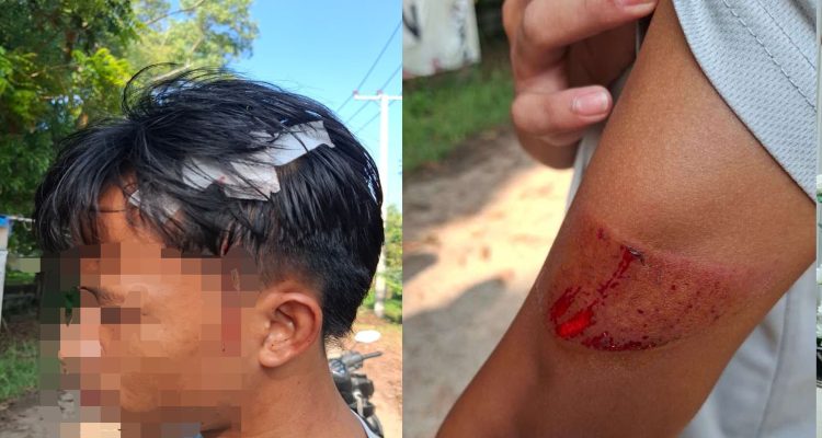 Seorang Atlet Alami insiden Pengeroyokan dan Sabetan Sajam di Area PKOR Way Halim Seorang Atlet Alami insiden Pengeroyokan dan Sabetan Sajam di Area PKOR Way Halim