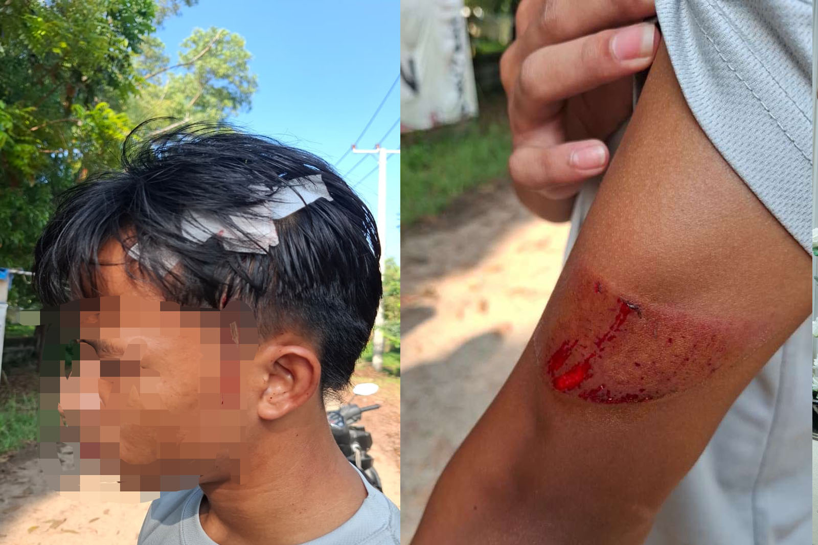 Seorang Atlet Alami insiden Pengeroyokan dan Sabetan Sajam di Area PKOR Way Halim